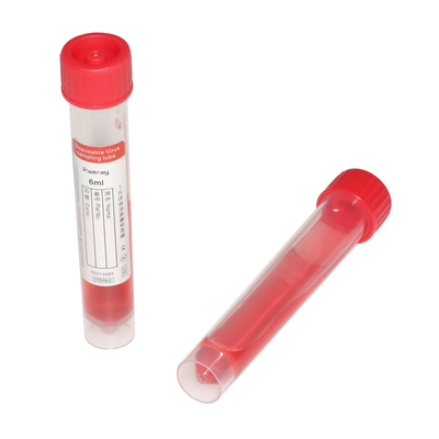 Van de Zwabberkit polypropylene tube with van VTM Nasopharyngeal Certificatie van Ce