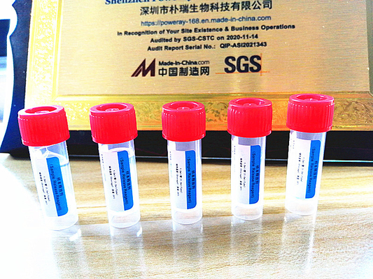 SGS Goedkeuringspcr de Extractie van van de Uitrustingsdna en RNA van het Testhuis voor covid-19