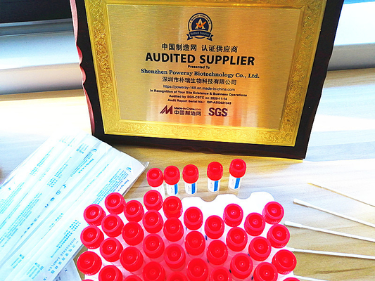PCR van de RNAextractie van de virussteekproef Snelle Test Kit No Extractor